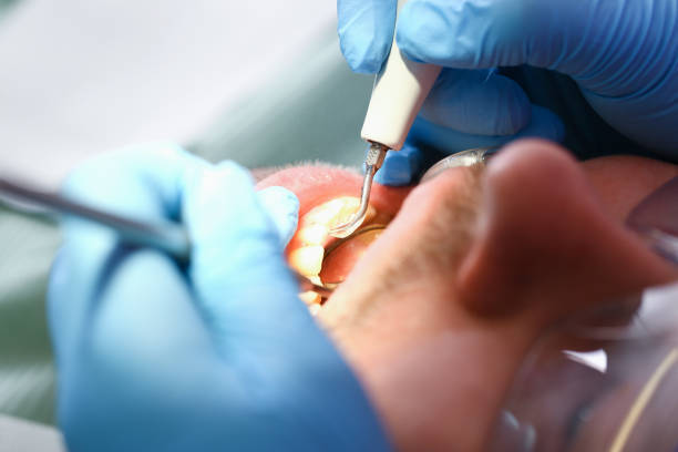 Best Urgent Dental Care in White Pigeon, MI
